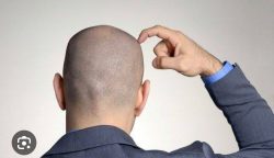 Caleg EC Sampaikan Klarifikasi Tertulis Atas Dugaan Pemukulan Wanita di THM