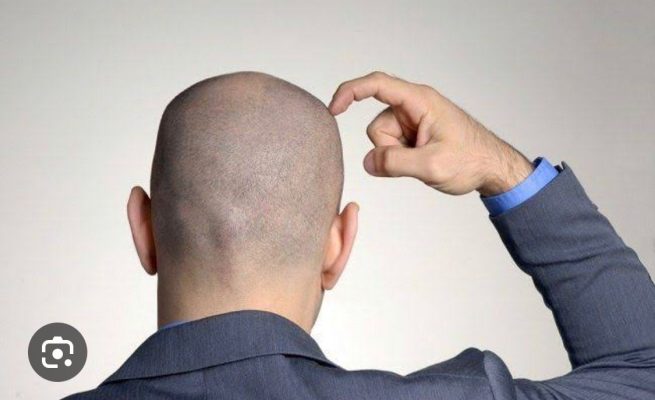 Caleg EC Sampaikan Klarifikasi Tertulis Atas Dugaan Pemukulan Wanita di THM