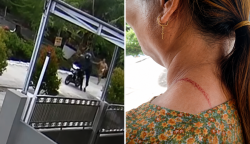 Kalung Emas 30 Gram Dirampas di Leher Korban hingga Luka, Aksi Jambret Terekam CCTV