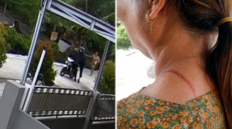 Kalung Emas 30 Gram Dirampas di Leher Korban hingga Luka, Aksi Jambret Terekam CCTV