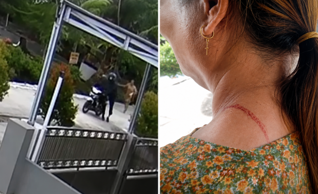 Kalung Emas 30 Gram Dirampas di Leher Korban hingga Luka, Aksi Jambret Terekam CCTV