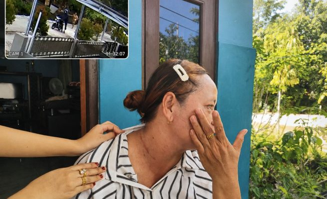 Korban Ungkap Detik-detik Penjambretan Kalung Emas di RTA Milono hingga Alami Luka